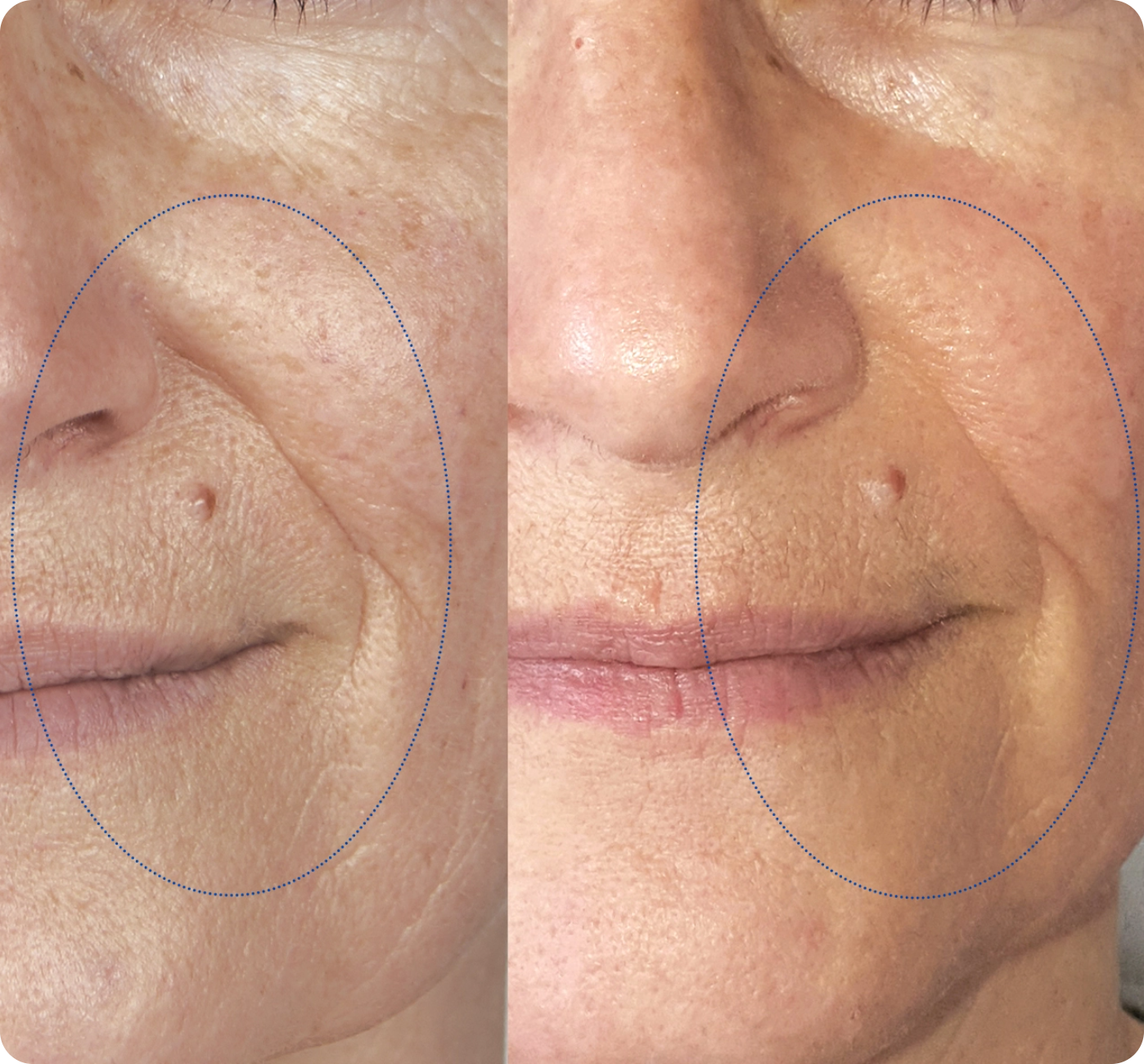 before_after_Serum