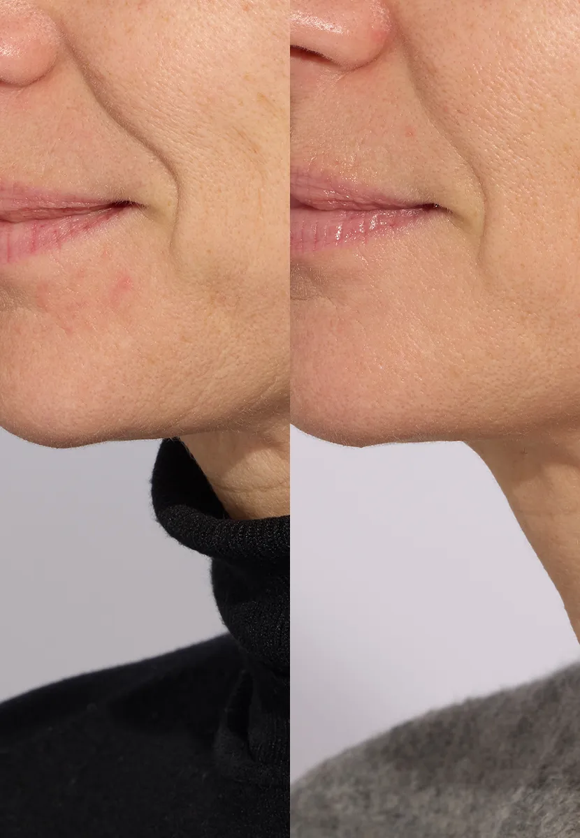 New Resveratrol-Lift Serum