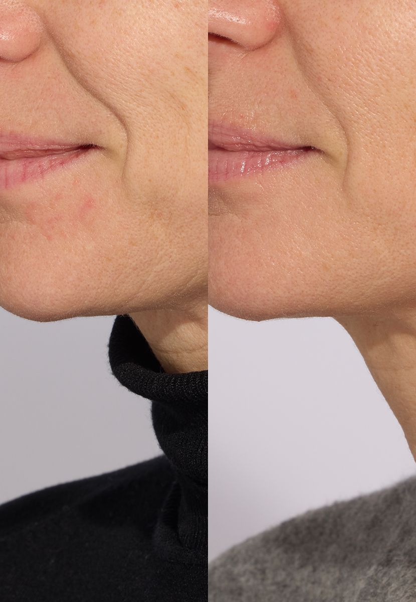 New Resveratrol-Lift Serum